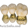 Протезирование зубов на основе металлокерамики  