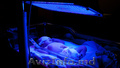 АРЕНДА МЕДИЦНСКОЙ Лампы для Лечение ДЕТСКОЙ желтухи новорожденных ! 069495004