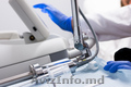 Tratament laser pentru vegetatiile veneriene (condiloamele,  condyloma acuminata, 